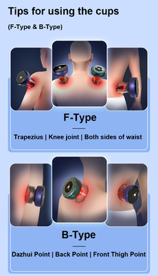 OEM/ODM Body Fitdash F-Type Cupping Cups for Customized Hijama Cupping Therapy Massager