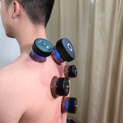 Fitdash Infrared Cupping Electric Vacuum Cupping Massage Body Cups Cupping Machine Vacuum Therapy