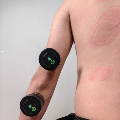 Massage Equipment Intelligent Vacuum Cupping Massager Set with Type-C Power Mode