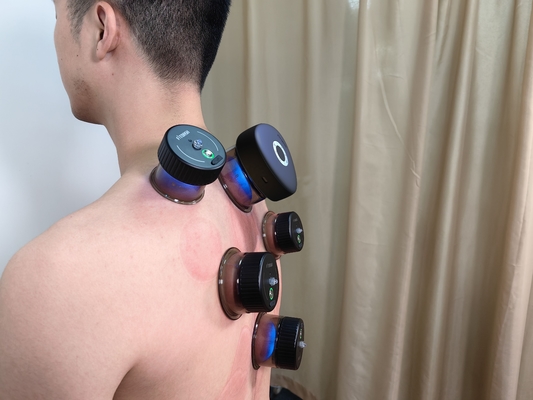 Experience the Future of Cupping Therapy with Fitdash Smart Massager Button Control