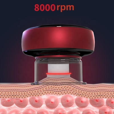 Class II Fitdash Intelligent Smart Cupping Device Vacuum Cupping Therapy Machine
