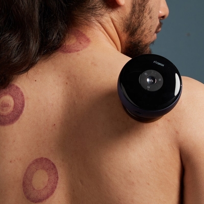 ABS PC Fitdash Electric Cupping Massager with Vacuum Suction and Electronic Vibration