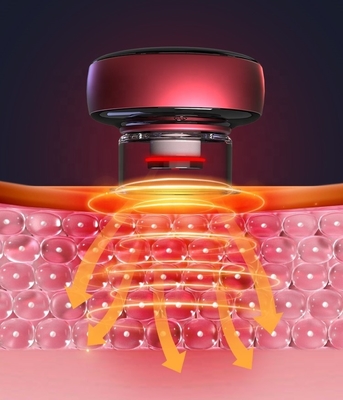 Intelligent Electric Infrared Therapy Cupping Machine with Suction Strength of 60-0kPa