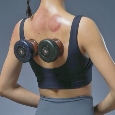 Fitdash Red Light Therapy Device for Wireless and Moxa Cupping Treatment on Body