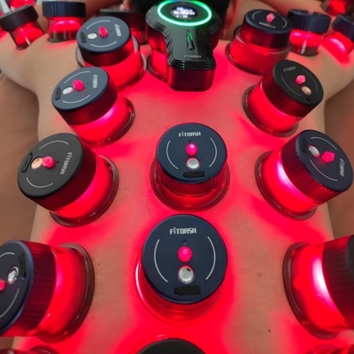 Enhance Your Cupping Experience with Fitdash Smart Cupping Device's Infrared Red Light