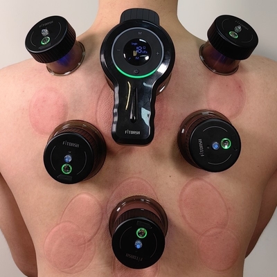 Fitdash Rechargeable Smart Cupping Cups The Perfect Addition to Your Wellness Routine
