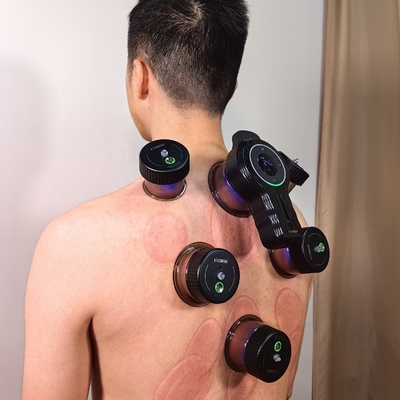 Intelligent Breathing Cupping with -10kPa--60kPa Suction Strength and 3.7V/150mAh Cup