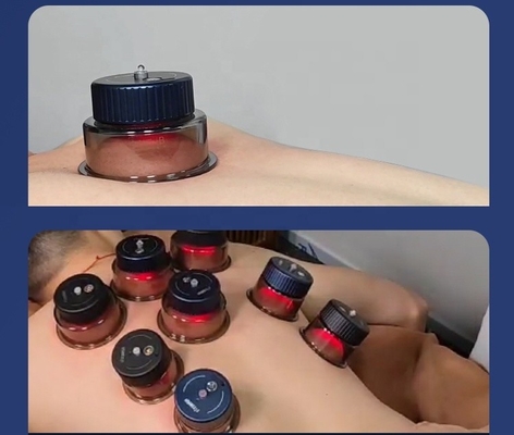 Intelligent Breathing Cupping with -10kPa--60kPa Suction Strength and 3.7V/150mAh Cup
