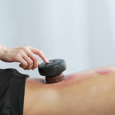 Fitdash Electric Cupping Massage with Red Light Therapy for Pain Relief EMC Certified