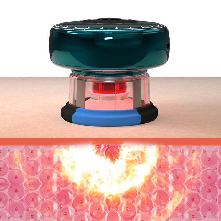 Fitdash TENS Smart Vacuum Cupper Chargeable and Easy to for Improved Blood Circulation