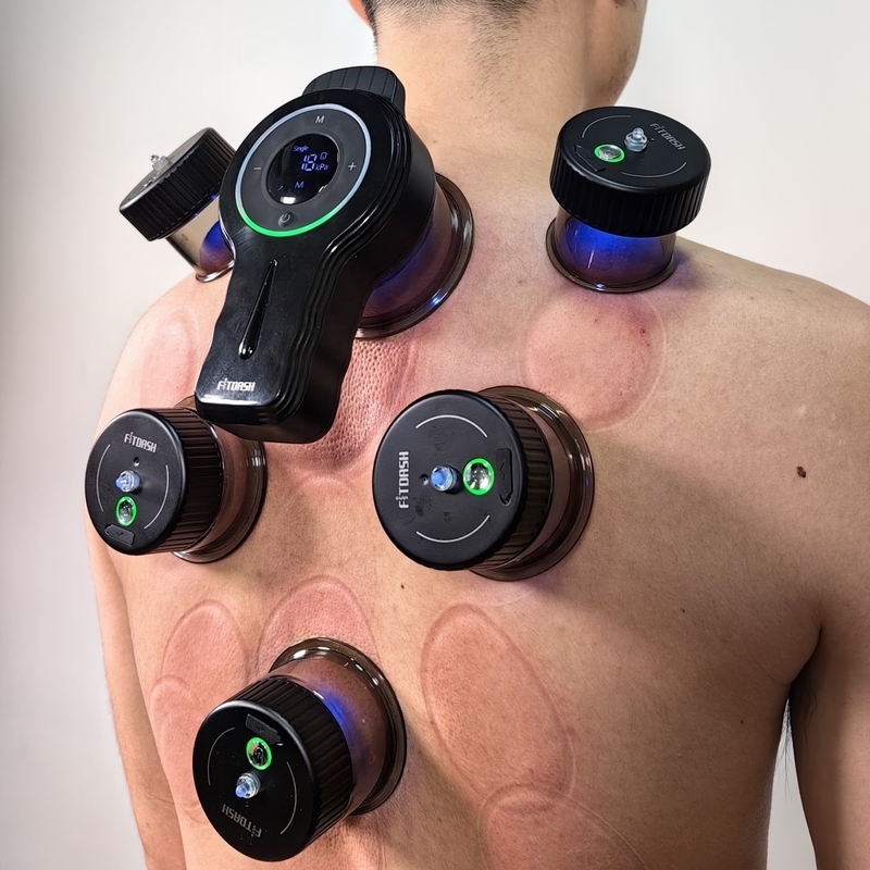 SUPPORT ODM/OEM Fitdash Upgraded Intelligent Electric Vacuum Cupping Set for Gua Sha