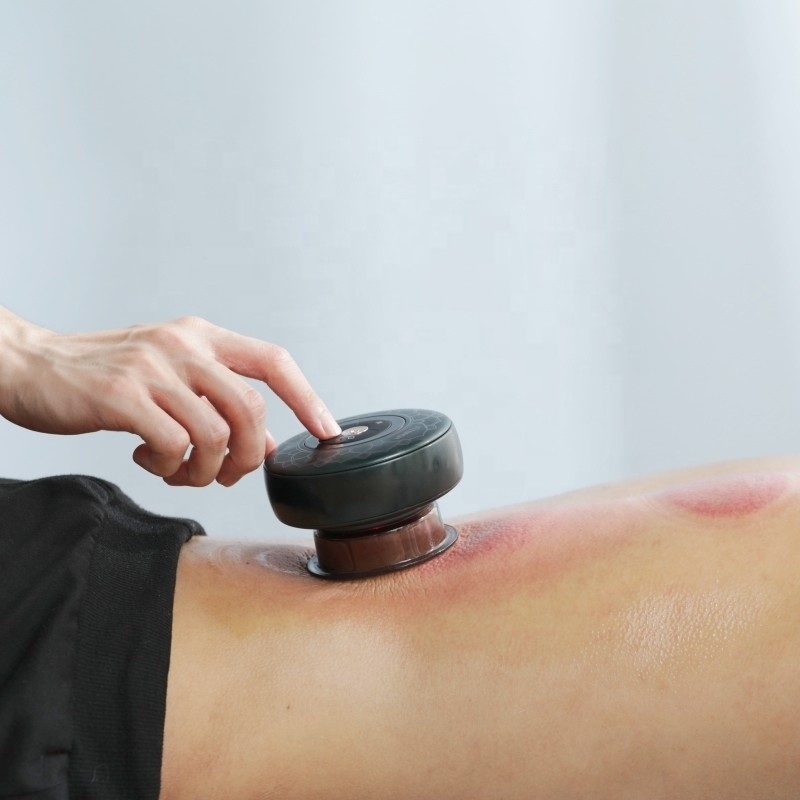 Fitdash Electric Cupping Massage with Red Light Therapy for Pain Relief EMC Certified